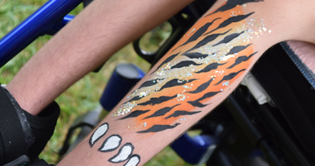 picture of the legs of a teenage boy sitting in his wheelchair. One leg has tiger stripes and teeth painted on it.